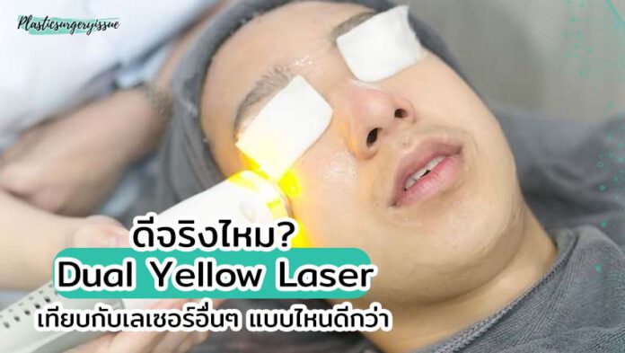 Dual Yellow Laser ช่วยให้หน้าใสจริงไหม